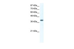 Aviva Systems Biology Corp TCFAP4 Antibody - middle region (ARP37416_T100)