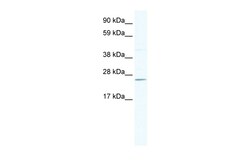 Aviva Systems Biology Corp DNAJC17 Antibody - N-terminal region (ARP37472_T100)