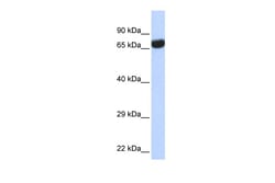 Aviva Systems Biology Corp TPTE Antibody - middle region (ARP37689_P050)