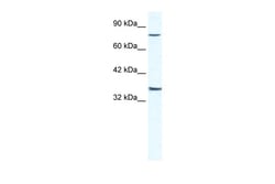 Aviva Systems Biology Corp ZNF337 Antibody - middle region (ARP37761_T100)