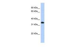 Aviva Systems Biology Corp ZNF511 Antibody - N-terminal region (ARP37809_P050)
