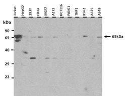 Aviva Systems Biology Corp TBX18 Antibody - C-terminal region (ARP37832_P050)