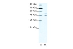Aviva Systems Biology Corp MITF Antibody - N-terminal region (ARP37977_T100)