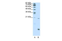 Aviva Systems Biology Corp RUNX1 Antibody - N-terminal region (ARP38073_P050)