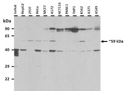 Aviva Systems Biology Corp SMARCD2 Antibody - C-terminal region (ARP38223_P050)