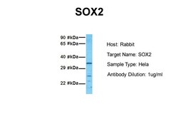 Aviva Systems Biology Corp SOX2 Antibody - N-terminal region (ARP38232_T100)