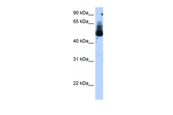 Aviva Systems Biology Corp TRIM21 Antibody - N-terminal region (ARP38247_T100)