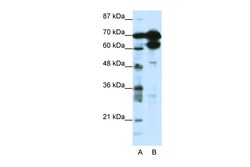 Aviva Systems Biology Corp ZNF76 Antibody - N-terminal region (ARP38325_T100)
