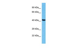 Aviva Systems Biology Corp EED Antibody - N-terminal region (ARP38384_P050)