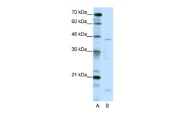 Aviva Systems Biology Corp TRIP13 Antibody - C-terminal region (ARP38434_T100)