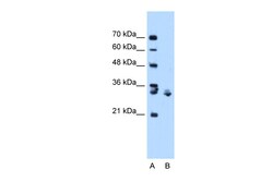Aviva Systems Biology Corp XBP1 Antibody - C-terminal region (ARP38553_P050)