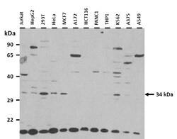 Aviva Systems Biology Corp TLX1 Antibody - N-terminal region (ARP38630_P050)