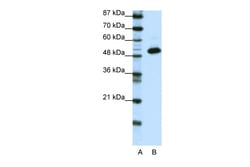 Aviva Systems Biology Corp TADA3L Antibody - N-terminal region (ARP38785_P050)