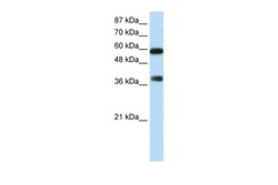 Aviva Systems Biology Corp ARID3B Antibody - C-terminal region (ARP38798_P050)
