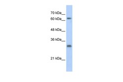 Aviva Systems Biology Corp USP39 Antibody - N-terminal region (ARP38825_P050)