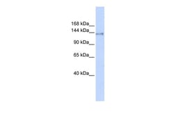 Aviva Systems Biology Corp SUPT16H Antibody - middle region (ARP38921_P050)