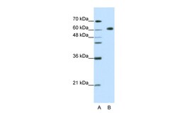 Aviva Systems Biology Corp GMEB2 Antibody - C-terminal region (ARP38990_T100)