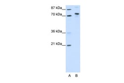Aviva Systems Biology Corp KIAA0737 Antibody - N-terminal region (ARP39144_T100)
