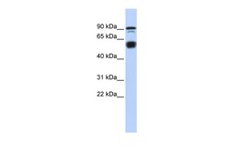 Aviva Systems Biology Corp BCL11A Antibody - N-terminal region (ARP39322_P050)