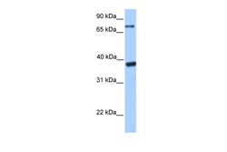Aviva Systems Biology Corp DIDO1 Antibody - C-terminal region (ARP39544_P050)