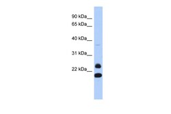 Aviva Systems Biology Corp NEUROG2 Antibody - N-terminal region (ARP39585_P050)