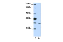 Aviva Systems Biology Corp ZNF397 Antibody - C-terminal region (ARP39691_T100)