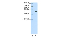 Aviva Systems Biology Corp PGBD1 Antibody - N-terminal region (ARP39703_T100)