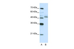 Aviva Systems Biology Corp ZNF342 Antibody - C-terminal region (ARP39859_P050)