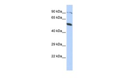 Aviva Systems Biology Corp ZNF641 Antibody - middle region (ARP39880_P050)