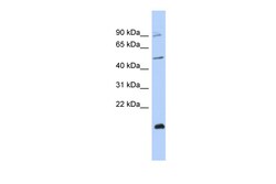 Aviva Systems Biology Corp CBLL2 Antibody - middle region (ARP39909_P050)