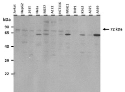 Aviva Systems Biology Corp HIF3A Antibody - C-terminal region (ARP39936_T100)