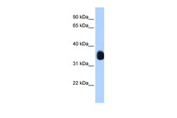Aviva Systems Biology Corp MLX Antibody - N-terminal region (ARP39966_T100)
