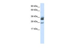 Aviva Systems Biology Corp SIRT5 Antibody - C-terminal region (ARP40125_T100)