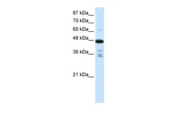 Aviva Systems Biology Corp PRMT2 Antibody - N-terminal region (ARP40196_T100)