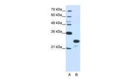 Aviva Systems Biology Corp ANP32A Antibody - N-terminal region (ARP40204_T100)