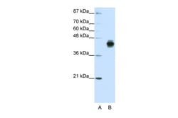 Aviva Systems Biology Corp KRT18 Antibody - C-terminal region (ARP40206_T100)