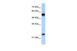 Aviva Systems Biology Corp RPL13 Antibody - C-terminal region (ARP40218_T100)