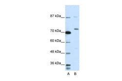 Aviva Systems Biology Corp EXOSC10 Antibody - C-terminal region (ARP40225_T100)