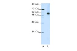Aviva Systems Biology Corp HNRPL Antibody - N-terminal region (ARP40240_T100)