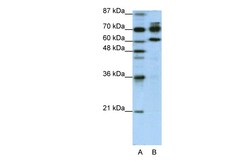 Aviva Systems Biology Corp ADARB1 Antibody - N-terminal region (ARP40342_T100)
