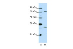 Aviva Systems Biology Corp AUH Antibody - C-terminal region (ARP40374_P050)