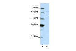 Aviva Systems Biology Corp HNRPK Antibody - N-terminal region (ARP40388_P050)