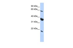 Aviva Systems Biology Corp SRPRA Antibody - middle region (ARP40460_P050)