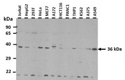 Aviva Systems Biology Corp EIF2S1 Antibody - N-terminal region (ARP40507_P050)