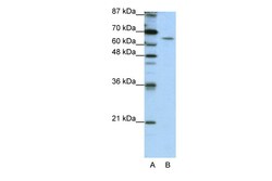 Aviva Systems Biology Corp STAU1 Antibody - N-terminal region (ARP40537_T100)