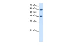 Aviva Systems Biology Corp RRP9 Antibody - middle region (ARP40546_T100)