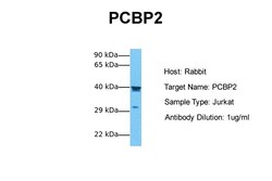 Aviva Systems Biology Corp PCBP2 Antibody - middle region (ARP40568_T100)