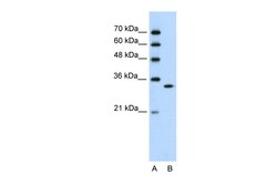 Aviva Systems Biology Corp RNASEH2A Antibody - C-terminal region (ARP40646_P050)