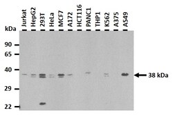 Aviva Systems Biology Corp HNRPH3 Antibody - N-terminal region (ARP40721_T100)