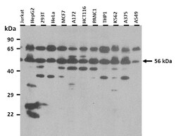 Aviva Systems Biology Corp SLA Antibody - N-terminal region (ARP41159_P050)
